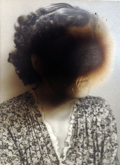 clinckx photo burned 1998